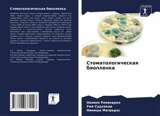 Bookcover of Стоматологическая биопленка