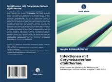 Bookcover of Infektionen mit Corynebacterium diphtheriae.