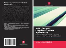 Bookcover of Infecções por Corynebacterium diphtheriae