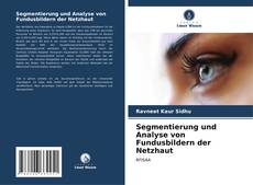 Capa do livro de Segmentierung und Analyse von Fundusbildern der Netzhaut 