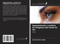 Segmentación y análisis de imágenes del fondo de ojo的封面