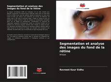 Segmentation et analyse des images du fond de la rétine kitap kapağı