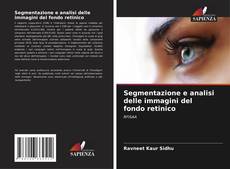 Bookcover of Segmentazione e analisi delle immagini del fondo retinico