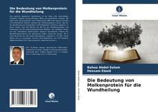 Bookcover of Die Bedeutung von Molkenprotein für die Wundheilung