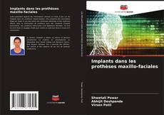 Bookcover of Implants dans les prothèses maxillo-faciales