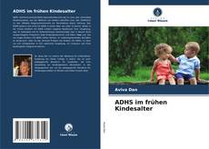 Bookcover of ADHS im frühen Kindesalter