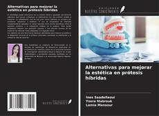 Bookcover of Alternativas para mejorar la estética en prótesis híbridas