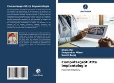 Computergestützte Implantologie kitap kapağı