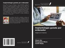 Buchcover von Implantología guiada por ordenador