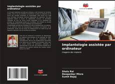 Capa do livro de Implantologie assistée par ordinateur 