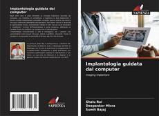 Buchcover von Implantologia guidata dal computer
