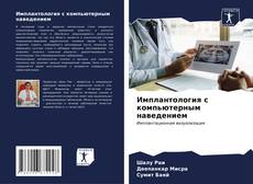 Bookcover of Имплантология с компьютерным наведением