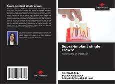 Buchcover von Supra-implant single crown: