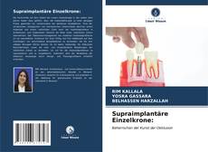 Bookcover of Supraimplantäre Einzelkrone: