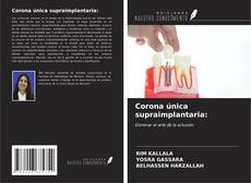 Corona única supraimplantaria: kitap kapağı