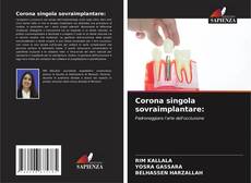 Bookcover of Corona singola sovraimplantare: