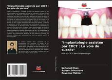 "Implantologie assistée par CBCT : La voie du succès"的封面