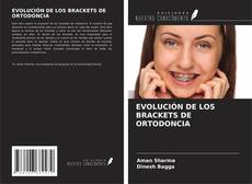 Bookcover of EVOLUCIÓN DE LOS BRACKETS DE ORTODONCIA