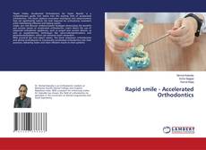Copertina di Rapid smile - Accelerated Orthodontics