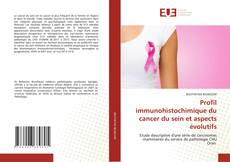 Couverture de Profil immunohistochimique du cancer du sein et aspects évolutifs