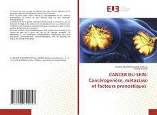 Couverture de CANCER DU SEIN: Cancérogenèse, métastase et facteurs pronostiques