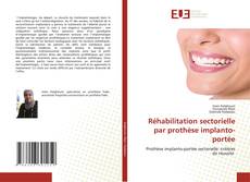 Bookcover of Réhabilitation sectorielle par prothèse implanto-portée