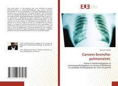 Borítókép a  Cancers broncho-pulmonaires - hoz