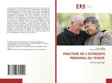 Borítókép a  FRACTURE DE L’EXTREMITE PROXIMAL DU FEMUR - hoz