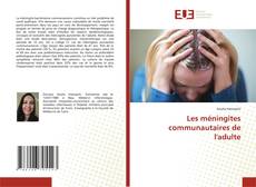 Bookcover of Les méningites communautaires de l'adulte