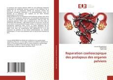 Bookcover of Reparation coelioscopique des prolapsus des organes pelviens
