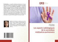 Capa do livro de Les aspects radiologiques de la sarcoidose médisatino-pulmonaire 