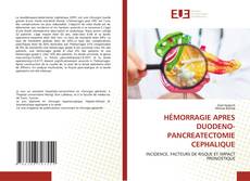 Borítókép a  HÉMORRAGIE APRES DUODENO-PANCREATECTOMIE CEPHALIQUE - hoz