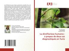 Bookcover of La dirofilariose humaine : à propos de deux cas diagnostiqués en Tunis