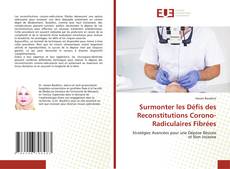 Bookcover of Surmonter les Défis des Reconstitutions Corono-Radiculaires Fibrées