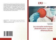 Bookcover of Les nouvelles techniques d'identification à partir d'hémocultures