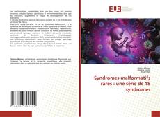Couverture de Syndromes malformatifs rares : une série de 18 syndromes