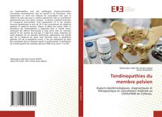 Bookcover of Tendinopathies du membre pelvien