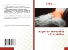 Imagerie des arthropathies microcristallines的封面