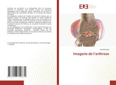 Bookcover of Imagerie de l’arthrose