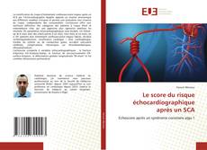 Bookcover of Le score du risque échocardiographique après un SCA