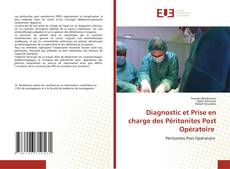 Bookcover of Diagnostic et Prise en charge des Péritonites Post Opératoire