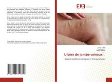 Ulcère de jambe veineux : kitap kapağı