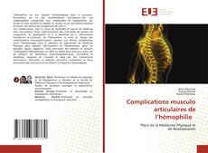 Couverture de Complications musculo articulaires de l’hémophilie
