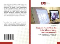 Обложка Imagerie mammaire des lésions bégnines en pratique générale