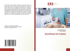 Buchcover von Anesthésie de l'obèse