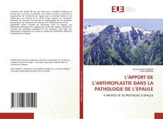 Buchcover von L’APPORT DE L’ARTHROPLASTIE DANS LA PATHOLOGIE DE L’EPAULE