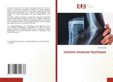 Bookcover of Lésions osseuses kystiques