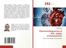 Électrocardiogramme et SCA , piégés d’interprétation kitap kapağı