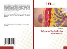 Buchcover von Échographie des kystes mammaires