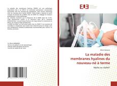 Bookcover of La maladie des membranes hyalines du nouveau-né à terme